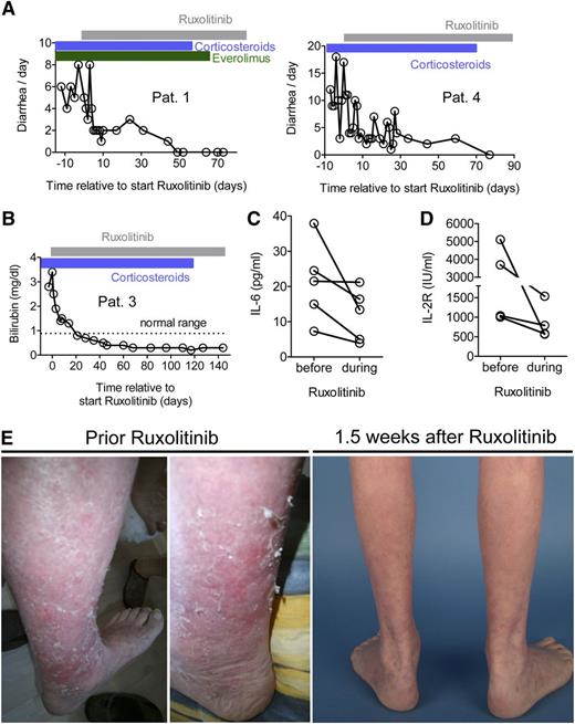 Figure 5. Ruxolitinib reduces GVHD in patients with acute corticosteroid-refractory GVHD. All patients were refractory to steroids and at least 2 other lines of treatment of GVHD (see also Table 1). (A) Two patients with histologically proven intestinal GVHD grade IV were treated with ruxolitinib as described in Methods. The frequency of diarrhea decreased in both patients. No other immunosuppressive therapy was started at the same time point. The patients also had corticosteroids and everolimus when ruxolitinib was started, and corticosteroids could be tapered in both patients during ruxolitinib treatment. (B) One patient with clinically diagnosed liver GVHD grade III was treated with ruxolitinib 5 mg twice per day for the first 3 days and then 10 mg twice per day continuously. The bilirubin level decreased after ruxolitinib treatment. No other immunosuppressive therapy was started at the same time point but corticosteroid treatment (blue area) was reduced by 50% and then discontinued in the observation period. The patient received no additional liver toxic agent that was discontinued during the entire time that is displayed. (C-D) The IL-6 and soluble IL-2R were measured before and after the start of ruxolitinib (range, 1-2 days before at latest 8 days after treatment start). The levels of these serum parameters declined in all analyzed patients. (E) A representative patient with cutaneous GVHD is shown before and 1.5 weeks after ruxolitinib. The patient characteristics and responses are summarized in Table 1 and supplemental Table 1.
