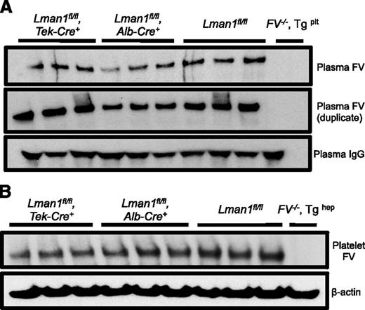 Figure 3. Relative FV antigen in plasma and platelets of Lman1 conditional knockout mice. (A) Platelet-poor plasma (equal volume) and (B) isolated platelets (equal number) from conditional Lman1 knockout mice and littermate control mice were analyzed for relative FV antigen levels by western blot. The same plasma samples were run twice as duplicates. Plasma immunoglobulin G serves as a loading control for the plasma samples, and β-actin serves as a loading control for platelets. Three adult mice were analyzed per genotype. Plasma from F5−/− mice carrying a platelet-specific F5 transgene30 was included as a negative control for the plasma samples. Similarly, platelets isolated from a F5−/− mouse carrying a hepatocyte-specific F5 transgene30 were included as a negative control for the platelet samples.