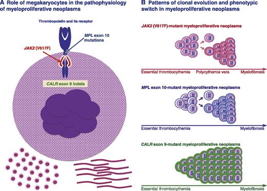 Figure 1. Role of megakaryocytes in the pathophysiology of myeloproliferative neoplasms, and patterns of clonal evolution and phenotypic switch in these disorders. (A) Megakaryocyte carrying a somatic mutation in JAK2, MPL, or CALR, all representing gain-of-function mutations of thrombopoietin signaling through its receptor. How a mutant calreticulin involves gain of thrombopoietin signaling is currently under investigation, but the available evidence strongly supports this notion. Enhanced thrombopoietin signaling results in excessive platelet production and, likely, also in abnormal megakaryocyte contribution to the bone marrow matrix environment, leading to thrombocytosis initially and to bone marrow fibrosis in the long term. (B) Patterns of clonal evolution and phenotypic switch in different genotypic entities. Clonal evolution of JAK2 (V617F)-mutant myeloproliferative neoplasms is associated with acquired copy-neutral loss of heterozygosity of chromosome 9p, responsible for the transition from heterozygosity to homozygosity for JAK2 (V617F). This may involve a phenotypic switch from essential thrombocythemia to polycythemia vera, and in the long term, from this latter to myelofibrosis. Essential thrombocythemia may also progress directly to myelofibrosis without the intermediate stage of polycythemia vera. Clonal evolution of MPL-mutant myeloproliferative neoplasms is associated with acquired copy-neutral loss of heterozygosity of chromosome 1p, involving transition from heterozygosity to homozygosity for the MPL mutation. This molecular mechanism and/or cooperating mutations may be responsible for a phenotypic switch from essential thrombocythemia to myelofibrosis. Clonal evolution of CALR-mutant myeloproliferative neoplasms appears to be mainly associated with a progressive expansion of a mutant heterozygous clone that eventually becomes fully dominant in the bone marrow. Activation of megakaryocytes by mutant CALR and/or cooperating mutations may be responsible for a phenotypic switch from essential thrombocythemia to myelofibrosis. Within each genotypic entity, thrombocythemia is likely the initial phenotype. Transition from one phenotype to another may or may not occur, depending on several factors, and transition rates may vary considerably. According to the pathophysiologic model depicted here, myelofibrosis is a late stage in the evolution of the different myeloproliferative neoplasms.