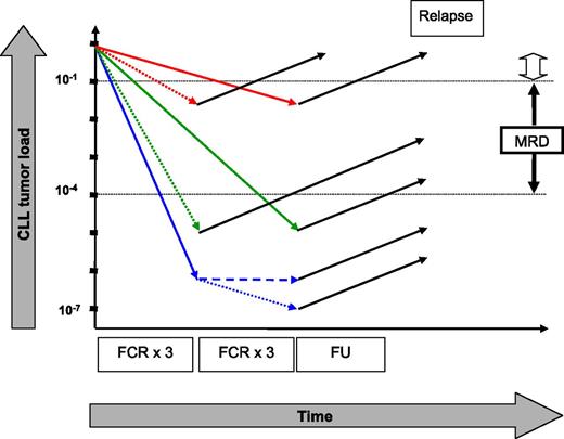 Hypothetical kinetics of tumor load in CLL patients who received 3 or 6 courses of FCR. Patients remaining MRD positive after treatment have a high likelihood of relapse (red arrows), whereas only 1 relapse was observed in MRD-negative patients (green and blue arrows). Three additional courses of FCR for patients who attained MRD negativity after the first 3 courses of FCR might be inefficacious (broken blue line) or might induce an additional reduction in tumor load (dotted blue line) that will translate into a clinical benefit with longer follow-up (FU designates current follow-up). The open arrow symbolizes the sensitivity of clinical staging. The figure is not to scale. See Figure 3A in the article by Strati et al that begins on page 3727.