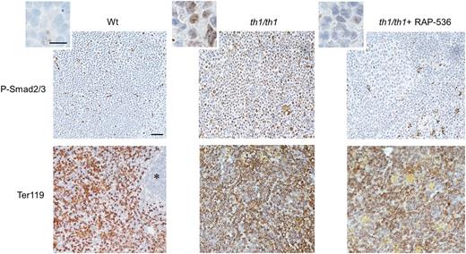 Figure 1. RAP-536 inhibits Smad2/3 activation in Hbbth1/th1 mice. (Upper) Representative phospho-Smad2/3 immunostaining (brown) in hematoxylin-counterstained spleen sections from a wild-type mouse (Wt), a vehicle-treated Hbbth1/th1 mouse (th1/th1), and an Hbbth1/th1 mouse treated for 12 hours with a single dose of RAP-536 (30 mg/kg, intraperitoneally, n = 3-4 mice per group). (Insets) Higher magnification. (Lower) Representative Ter119 immunostaining (brown) denoting red pulp in adjacent hematoxylin-counterstained spleen sections. *White pulp. Images were obtained with a 20× objective or 100× oil immersion objective. Bar = 100 or 15 µm (insets).