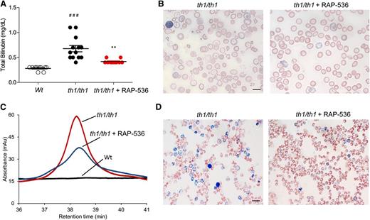 Figure 4. Effects of RAP-536 on hemolysis, RBC morphology, Heinz bodies, and α-globin chain distribution in Hbbth1/th1 mice. Hbbth1/th1 mice (3-4 months old) were treated with RAP-536 or vehicle as in Figure 2, and age-matched wild-type mice treated with vehicle were used as additional controls. (A) Total bilirubin concentration (n = 10-13 mice per group). (B) Blood smears treated with Wright-Giemsa stain to reveal effects of RAP-536 on RBC morphology, reticulocyte number, cellular debris, and degree of poikilocytosis. (C) Representative high-performance liquid chromatogram showing reduction of α-globin aggregates in erythrocyte membranes from Hbbth1/th1 mice treated with RAP-536. Mean levels of α-globin aggregates were reduced 38% by RAP-536 treatment. n = 3 to 5 mice per group. (D) Blood cells stained supravitally with new methylene blue and counterstained with Wright-Giemsa to reveal Heinz bodies. Images in B and D were obtained with a 100× oil immersion objective; bar = 10 µm. Data are means ± SEM. ###P < .001 vs wild type; **P < .01, RAP-536 vs vehicle.