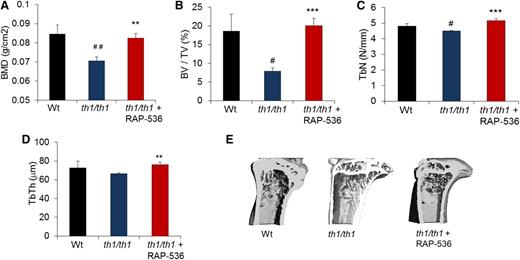 Figure 6. Effect of RAP-536 on bone in Hbbth1/th1 mice. Hbbth1/th1 mice (3-4 months old) were treated with RAP-536 or vehicle as in Figure 2, and age-matched wild-type mice treated with vehicle were used as additional controls. (A) BMD (n = 8-13 mice per group). (B-D) BV/TV, TbN, and TbTh (n = 4-6 mice per group). (E) Representative 3-dimensional images of proximal tibiae generated from microcomputed tomography analysis. Data are means ± SEM. #P < .05 and ##P < .01 vs wild type; *P < .05, **P < .01, and ***P < .001, RAP-536 vs vehicle. BMD, bone mineral density; BV/TV, bone volume fraction; TbN, trabecular number; TbTh, trabecular thickness.