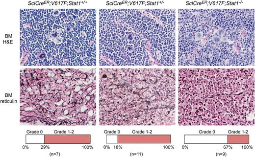Figure 2. Histopathology of SclCreER;V617F transgenic mice using H&E and Gömöri-stained BM samples (magnification, ×630). Transgenic mice were sacrificed 10 weeks after induction with tamoxifen. SclCreER;V617F;Stat1+/+ mice (n = 6) showed more features of MPN and myelofibrosis compared with SclCreER;V617F;Stat1−/− littermates (n = 3) (hypercellularity with trilineage hyperplasia, markedly increased numbers of megakaryocytes with morphologic abnormalities, hyperchromatic, hyperlobulated nuclei, and bizarre nuclear configuration, often forming clusters). Frequency of mice displaying grade 0 or grade 1-2 myelofibrosis is shown in the lower panel for each genotype.