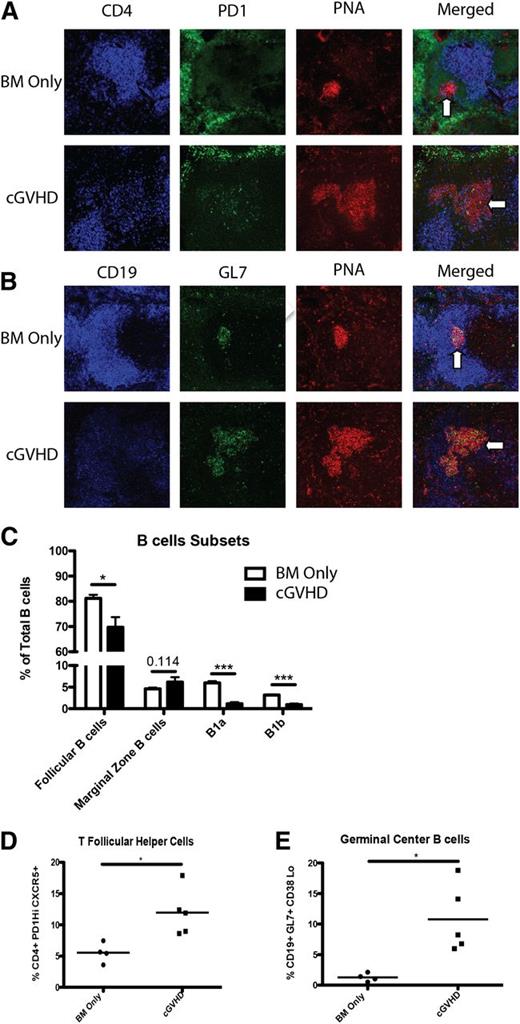 Figure 1. Increased Tfh cells in cGVHD. B10.BR mice were transplanted with BM only or BM and splenic T cells from B6 donor mice and spleens were harvested on day 60. (A) Representative spleens harvested from BM only and BM plus spleen mice on day 60 showing CD4 (blue), PD-1 (green), and peanut agglutinin (PNA) (red) or (B) CD19 (blue), GL7 (green), or PNA (red). Arrows indicate GC areas. (C) Composition of B cells in the spleen and peritoneal cavity. (D) Frequency of Tfh cells and (E) GC B cells. *P < .05; ***P < .001.