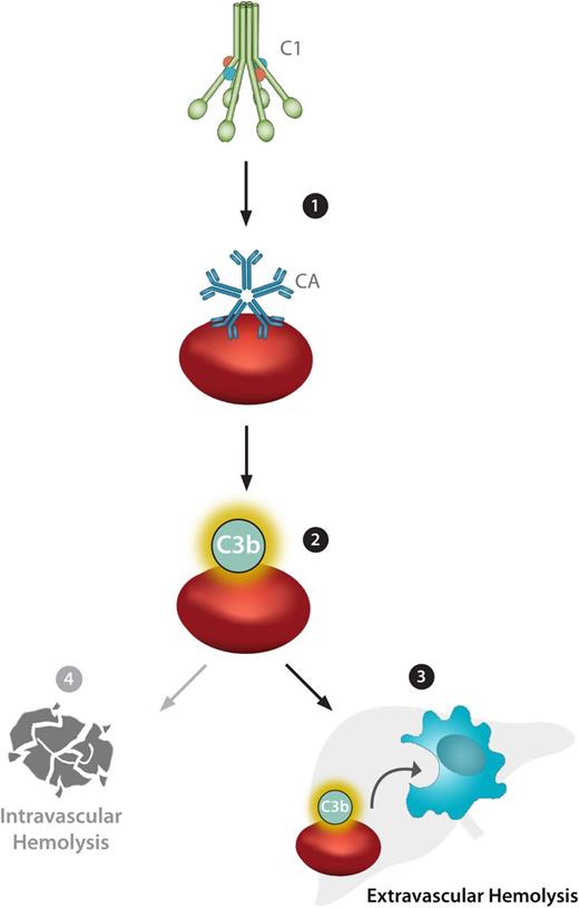 Figure 6. CA activation of the classical complement pathway on RBCs results in anemia in CAD patients. (1) CA-bound RBCs fix C1, the CP-activating complex, on the RBC surface, which triggers the classical complement cascade. (2) Activation of the CP results in complement opsonin deposition (C3b) on the RBC surface. (3) In general, CP activity terminates after C3 cleavage, and C3b/iC3b-opsonized RBCs then travel to the liver where they are phagocytosed by liver-resident macrophages, a process termed extravascular hemolysis. (4) Under exceptional circumstances such as immunologic stress that induces production of complement proteins, activation of the terminal complement cascade can occur, resulting in the formation of the membrane attack complex and direct cellular lysis known as intravascular hemolysis. By inhibiting classical complement pathway activation at the level of the C1 complex, an upstream CP inhibitor such as TNT003 can prevent both extra- and intravascular hemolysis.