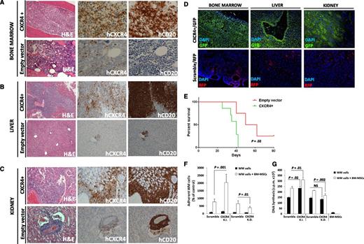 Figure 2. Overexpression of CXCR4 in WM cells leads to increased disease dissemination in vivo and enhanced adhesion properties and growth in vitro. CXCR4 overexpressing cells (CXCR4+) presented with a more aggressive ability to disseminate to BM (A), liver (B), and kidneys (C) compared with the related empty vector–infected cells (Hematoxylin Eosin ×10; Ab staining ×20 and ×10, magnifications). Quantification of human CD20 and CXCR4 staining is shown in supplemental Figure 2. In addition, CXCR4+ and control cells were detected ex vivo by using immunofluorescence on BM, liver, and kidney tissues (D) (×10 and ×20 magnifications). (E) Kaplan-Meier curve showing decreased survival in CXCR4+ cell–injected mice vs empty vector cell–injected mice (n = 7/group). Death for empty vector cell–injected mice was observed at days 40, 50, and 62. P indicates P value (log-rank test). (F-G) CXCR4 overexpression led to increased WM cell adhesion to primary BM-MSCs, and increased cell proliferation in contrast with CXCR4-silenced WM cells (CXCR4-K.D.), in which reduced adhesion to BM-MSCs and reduced cell proliferation were observed. Bars indicate standard deviation. DAPI, 4′,6 diamidino-2-phenylindole; NS, not significant.