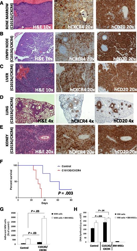 Figure 3. CXCR4/C1013G mutation drives dissemination of WM cells in vivo. WM cells harboring the C1013G/CXCR4 variant present with changes at the mRNA level, together with increased cell adhesion and cell proliferation. SCID/Bg mice injected IV with C1013G/CXCR4 variant-harboring WM cells presented with significant involvement of (A) BM, (B) lymph nodes, (C) liver, (D) lung, (E) kidneys (×4, ×10, and ×20 magnifications). Quantification of human CD20 and CXCR4 staining is shown in supplemental Figure 4. (F) Kaplan-Meier curve showing decreased survival in C1013G/CXCR4 cell–injected mice vs control vector cell–injected mice (n = 7/group). Death for control vector cell–injected mice was observed at days 37, 48, and 62. (G-H) C1013G/CXCR4 variant increased adhesion and proliferation of WM cells either alone or in the context of BM-MSCs. Bars indicate standard deviation. P indicates P values.
