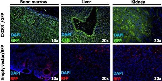 CXCR4+ overexpressing WM cells with aggressive ability to disseminate to bone marrow, liver, and kidney in SCID/Bg mice as demonstrated by immunofluorescence imaging of GFP-tagged CXCR4+ WM cells. DAPI, 4′,6 diamidino-2-phenylindole; RFP, red fluorescent protein. Adapted from Figure 2D in the article by Roccaro et al that begins on page 4120.