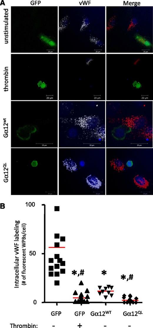 Figure 5. Confocal microscopy of Gα12 and vWF. Mutationally-activated Gα12 stimulates WPB exocytosis. (A) HUVECs were transfected with GFP alone (negative control) or GFP-tagged Gα12WT or Gα12Q229L constructs. After 4 h of serum starvation, GFP-expressing HUVECs were incubated for 15 minutes with vehicle (unstimulated) or 25 nM thrombin. WPBs were visualized by vWF immunofluorescent staining (red). Single confocal optical sections (pinhole set to achieve 1 Airy unit) are shown; bars correspond to 20 µm. (B) Fluorescent WPBs per cell were quantified as described in Materials and methods. Red horizontal bars represent median values. *P < .05 by analysis of variance vs unstimulated GFP-alone expressing cells. *,#P < .05 vs all other groups.