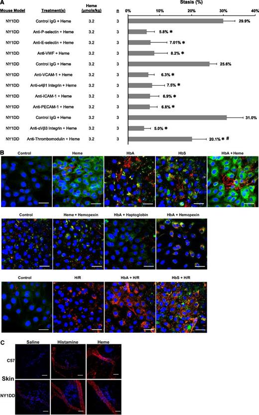 Figure 2. Multiple EC adhesion molecules are required for stasis including mobilization of WPB constituents P-selectin and VWF to the EC surface. (A) Blocking antibodies to adhesion molecules P-selectin, E-selectin, VWF, VCAM-1, α4β1 integrin, ICAM-1, PECAM-1, αVβ3 integrin, thrombomodulin, or control IgG (30 µg per mouse, IV) were infused into NY1DD sickle mice with DSFCs 5 minutes prior to infusion of heme (3.2 µmol/kg). Percent stasis was measured at 1 hour after heme infusion as described in Figure 1. *P < .001 vs control IgG and #P < .001 antithrombomodulin vs anti-P-selectin, E-selectin, VWF, VCAM-1, α4β1 integrin, ICAM-1, PECAM-1, or αVβ3 integrin. (B) HUVECs were fixed in 4% paraformaldehyde and stained for surface P-selectin (green) or VWF (red) after the indicated incubations. Nuclei were counterstained with DAPI (blue). White bars represent 40 µm. Representative cells are shown. Top row: HUVECs in 0.1% FBS were incubated with heme (20 µM) for 15 minutes, HbA or HbS (20 µM heme) for 24 hours, or HbA for 24 hours followed by heme for 15 minutes. Middle row: HUVECs were incubated with heme + hemopexin (20 μM), HbA + haptoglobin (20 µM), or HbA + hemopexin for 24 hours. Bottom row: HUVECs were incubated for 24 hours in 0.1% FBS with or without HbA or HbS followed by H/R (5% CO2/95% N2 for 3 hours and 5% CO2/95% air for 1 hour). Control cells were incubated in 0.1% FBS for 24 hours. Cells were not permeabilized; all pictures represent cell-surface expression. (C) Normal C57BL/6 and NY1DD sickle mice were infused with saline (12 mL/kg, negative control), histamine (1200 µmol/kg, positive control), or heme (3.2 µmol/kg). Fifteen minutes after infusion, mice were sacrificed in CO2 and dorsal skin (n = 1/treatment) was removed and fixed in Zamboni’s for immunofluorescence staining of VWF (red) and counterstaining of nuclei with DAPI (blue). White bars represent 30 µm. Representative venules are shown.