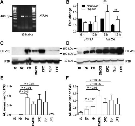 Figure 1. Human neutrophils express HIF-2α, and expression is up-regulated by hypoxia, hydroxylase inhibition, and heat-killed bacteria. (A) Expression of HIF2A in freshly isolated neutrophils (t0) or cells cultured for 4 hours in normoxia (N) or hypoxia (H) was determined by PCR and agarose gel electrophoresis. A representative gel image of n = 3 is shown. (B) Fold change in expression of HIF2A and HIF1A following culture of human neutrophils in normoxia (filled bars) or hypoxia (open bars) for 6 or 12 hours. TaqMan analysis of cDNA was performed with data normalized to ACTB expression. Data show mean and SEM of fold change with respect to normoxic samples at 6 hours, n = 3, analyzed by ANOVA. (C-D) Expression of HIF-1α and HIF-2α is differentially regulated by hydroxylase inhibitors and up-regulated in response to heat-killed bacteria. Neutrophils were cultured in normoxia (Nx) with dimethyloxalylglycine (DMOG; 100 µM); deferoxamine (DFO; 300 µM); heat-killed Streptococcus pneumoniae (Spn; multiplicity of infection 10:1); LPS (100 ng/mL); or hypoxia (Hx) before being lysed. Proteins were separated using SDS-polyacrylamide gel electrophoresis (PAGE), and blots were probed for (C) HIF-1α and (D) HIF-2α. p38 MAPK was used as a loading control. (E-F) Densitometry analysis was performed on (E) HIF-1α and (F) HIF-2α blots using ImageJ software and normalized to p38 MAPK expression. Data are mean and SEM for minute n = 4.