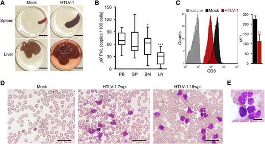 Figure 3. Splenomegaly and leukemic T-cell overgrowth in infected IBMI-huNOG mice. (A) Hepatosplenomegaly in HTLV-1–infected mice. Representative spleens and livers from mock- and HTLV-1–infected mice are shown. Scale bars in panel A represent 10 mm. (B) PVL in lymphoid organs of HTLV-1–infected mice. PVL in the peripheral blood (PB), spleen (SP), bone marrow (BM), and lymph nodes (LM) of HTLV-1–infected mice (n = 17) are shown. Box plots represent medians ± 1.5 IQR. Asterisks indicate statistical significance vs the value obtained from peripheral blood (*P < .05, ***P < .001 by paired t test). (C) Downregulation of CD3 on the T-cell surface. PBMCs from mock- (n = 3) and HTLV-1–infected mice (n = 18) were stained for human CD3 and analyzed by FACS. Results are presented as mean MFI ± SD of CD3 expression. (D-E) Smears of peripheral blood from HTLV-1–infected mice showing a number of leukemic cells with atypically shaped nuclei. Results from two infected mice (7 and 18 wpi, respectively) and a mock-infected mouse (at 8 mpt) are shown. Higher-magnification view of flower cells in panel D is shown in panel E. Scale bars in panels D-E represent 50 and 10 µm, respectively. Asterisks in panels B and C represent significant differences vs mock-infected mice (**P < .01 by Mann-Whitney U test).