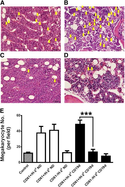 Figure 4. Allogeneic platelet MHC class I antigens rescue megakaryocyte abnormalities in T-cell–mediated ITP. Representative hematoxylin and eosin stained bone marrows of SCID mice transferred with CD19-depleted splenocytes from (A) a control BALB/c naïve mouse or BALB/c CD61 KO mice immunized against (B) BALB/c (CD61+/H-2d) platelets; (C) C57BL/6 (CD61+/H-2b) platelets; or (D) C57BL/6 CD61 KO (CD61−/H-2b) platelets. The bars in each panel represent 50 μm. The yellow arrows point to megakaryocytes. (E) Cumulative results of megakaryocyte enumeration in the bone marrow of control naïve SCID mice (hatched column), SCID mice transferred with either nondepleted splenocytes (antibody-mediated ITP) from the indicated platelet donors (white columns), and SCID mice transferred with CD19-depleted splenocytes (T-cell–mediated ITP) from the indicated platelet donors (black columns). At least 10 fields in each bone marrow were counted and the results are presented as the mean megakaryocyte number per field (***P < .001). Images of all panels were taken at ×40 original magnification with a 0.75 numerical aperture of the objective lens.