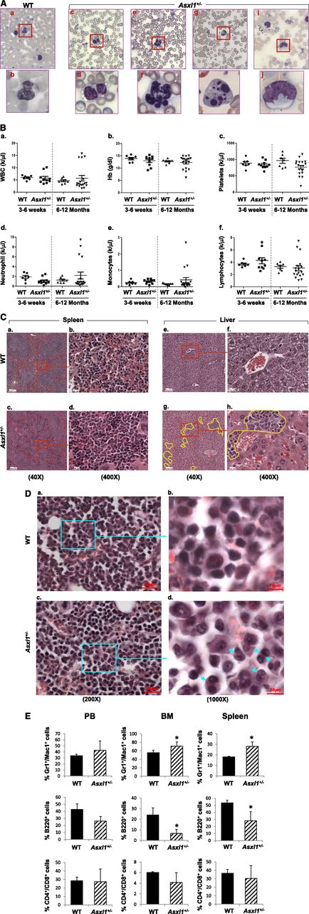 Figure 3. Haploinsufficiency of Asxl1 is sufficient for the development of MDS-like disease and MDS/MPN in mice. (A) May-Giemsa–stained PB smears prepared from representative adult WT (a-b) and Asxl1+/− (c-j) mice (6-12 months old) are shown. The PB smear of Asxl1+/− mice showed dysplastic features including bilobed and hyposegmented neutrophils with clumping chromatin consistent with pseudo–Pelger-Huët anomaly (c-d), hypersegmented neutrophils (e-f), and apoptotic neutrophils (g-h). The PB smear of representative Asxl1+/− mice showed monocytosis (i-j). (B) Parameters of PB were summarized from young WT (n = 7) and Asxl1+/− (3-6 weeks old, n = 10) and aged WT (n = 7) and adult Asxl1+/− (6-12 months old, n = 18) mice: WBC counts (a), Hb (b), platelets (c), neutrophils (d), monocytes (e), and lymphocytes (f). (C-D) Hematoxylin and eosin staining of paraffin-embedded sections of spleen (C, right), liver (C, left), and femurs (D), from representative aged WT and Asxl1+/− mice. Yellow lines represent areas containing infiltrating myeloid cells (Cg-h). Blue arrows indicate dysplastic cells (Dd). Spleen and liver: original magnification ×4 in (a), (c), (e), and (g); and original magnification ×40 in (b), (d), (f), and (h). BM: original magnification ×20 in (a) and (c), and original magnification ×100 in (b) and (d). (E) Quantitation of the percentage of Gr1+/Mac1+, B220+, and CD4+/CD8+ cell populations in PB, spleen, and BM of WT and Asxl1+/− mice (6-12 months old). Data are presented as mean ± SD from 5 sets of WT and Asxl1+/− littermates. *P < .05.