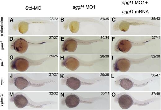 Figure 1. Knockdown of aggf1 expression results in abnormal primitive hematopoiesis during zebrafish embryogenesis. (A-C) Dramatic reduction of the number of erythroid cells by an aggf1 morpholino (MO1). Zebrafish embryos in the 1- to 2-cell stage were injected with 2 ng of Std-MO (A) or 2 ng of MO1 (B). Erythroid cells in the circulatory system were detected with o-dianisidine at 48 hpf. A similar experiment with injection of 2 ng of MO1 together with 100 pg of zebrafish aggf1 mRNA (C) into embryos was performed to determine whether overexpression of aggf1 can rescue the defects in aggf1 morphants. MO1 was designed in a manner to knock down endogenous zebrafish aggf1 mRNA only and does not knock down the in vitro synthesized aggf1 mRNA used for injection. (D-F) Knockdown of aggf1 reduces the gata1 signal, a marker for erythroid progenitors. Zebrafish embryos (1- to 2-cell stage) were injected with 2 ng of Std-MO (D), 2 ng of aggf1 MO1 (E), or 2 ng of aggf1 MO1 together with 100 pg of aggf1 mRNA (F) and used for WISH at 26 hpf with an antisense probe for gata1. (G-I) Knockdown of aggf1 reduces the pu.1 signal, a marker for myeloid progenitors. The embryos were injected and processed as in panels D-F, but with an antisense probe for pu.1. (J-O) Knockdown of aggf1 expression results in a reduced number of granulocytes and macrophages during zebrafish early embryogenesis. (J-L) Knockdown of aggf1 expression reduces the mpo signal, a marker for granulocytes. Zebrafish embryos (1- to 2-cell stage) were injected with 2 ng of Std-MO (J), 2 ng of aggf1 MO1 (K), or 2 ng of aggf1 MO1 together with 100 pg of aggf1 mRNA (L) and used for WISH at 28 hpf with an antisense probe for mpo. Knockdown of aggf1 expression reduces the l-plastin signal at 28 hpf, a marker for macrophages (M-O). All embryos are shown in a lateral view with the anterior on the left.