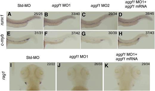Figure 2. Knockdown of aggf1 expression results in abnormal definitive hematopoiesis during zebrafish embryogenesis. Knockdown of aggf1 expression reduces the runx1 signal (A-D) or c-myb signal (E-H) in the ventral wall of the dorsal aorta, 2 independent markers for HSCs. Zebrafish embryos (1- to 2-cell stage) were injected with 4 ng of Std-MO (A,E), 2 ng of aggf1 MO1 (B,F), 4 ng of aggf1 MO2 (C,G), or 2 ng of aggf1 MO1 together with 100 pg of aggf1 mRNA (D,H) and used for WISH at 30 hpf with an antisense probe for runx1 or c-myb. Knockdown of aggf1 expression abolishes the rag1 signal, a marker for lymphoid cells, at 5 dpf (I-K). (A-H) Embryos are shown in a lateral view with the anterior on the left. (I-K) Embryos are shown as a dorsal view with the anterior at the top.