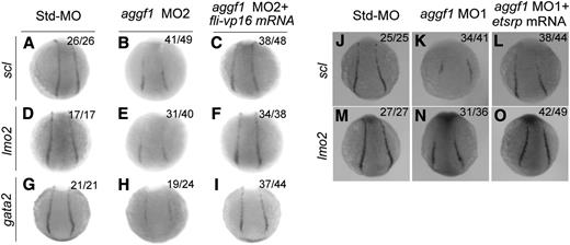 Figure 5. Overexpression of fli-vp16 or etsrp rescues defects in specification of hemangioblasts and hematopoietic cells in aggf1 morphants. (A-I) Zebrafish embryos (1- to 2-cell stage) were injected with Std-MO (4 ng; A,D,G), aggf1 MO2 (4 ng; B,E,H), or aggf1 MO2 (4 ng) together with fli-vp16 mRNA (75 pg) (C,F,I) and used for WISH at 10 somites with antisense probes for scl (A-C), lmo2 (D-F), and gata2 (G-I). Reduced expression of hemangioblast markers (scl, lmo2) in PLPM by aggf1 MO2 was restored by overexpression of fli-vp16 mRNA (A-F). Similarly, reduced expression of hematopoietic marker gata2 in PLPM by knockdown of aggf1 expression was restored by overexpression of fli-vp16 mRNA (G-I). (J-O) Zebrafish embryos (1- to 2-cell stage) were injected with Std-MO (2 ng; J,M), aggf1 MO1 (2 ng; K,N), or aggf1 MO1 (2 ng) together with etsrp mRNA (100 pg) (L, O) and used for WISH at 6 somites with antisense probes for scl (J-L) and lmo2 (M-O). Reduced expression of scl and lmo2 in PLPM by aggf1 MO1 was restored by overexpression of etsrp mRNA, suggesting that etsrp is downstream of aggf1 during differentiation of hemangioblasts. Embryos are shown in a dorsal view with the anterior at the top.