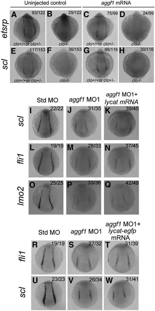 Figure 6. Zebrafish aggf1 and cloche act independently during differentiation of hemangioblasts. (A-H) Heterozygous clochem39 mutant zebrafish were mated with each other. The offspring embryos were injected with 100 pg of aggf1 mRNA and used for WISH at 10 somites with antisense probes for etsrp (A-D) and scl (E-H). (A-B) Uninjected control embryos (23.8%, 29/122) showed no detectable etsrp expression, whereas 76.2% (93/122) embryos showed nearly normal expression of etsrp at 10 somites. (C-D) No detectable etsrp expression was displayed in 24.2% (24/99) of the embryos, whereas 75.8% (75/99) embryos showed nearly normal expression of etsrp at 10 somites. (E-F) Uninjected control embryos (76.5%, 117/153) showed normal expression of scl, whereas 23.5% (36/153) of embryos did not display expression of scl at 10 somites. (G-H) No detectable scl expression was displayed in 25.8% (30/116) of the embryos, whereas 74.2% (86/116) of the embryos showed nearly normal expression of scl at 10 somites. The ratios are consistent with the autosomal recessive inheritance pattern (3:1), suggesting that injection of aggf1 mRNA did not alter the 3:1 ratio and did not rescue the expression of hemangioblast markers in clochem39 mutant embryos. (I-Q) Overexpression of lycat mRNA did not rescue abnormal hemangioblast phenotypes in aggf1 morphants. Zebrafish embryos (1- to 2-cell stage) were injected with Std-MO (2 ng; I,L,O), aggf1 MO1 (2 ng; J,M,P), or aggf1 MO1 (2 ng) together with lycat mRNA (100 pg) (K,N,Q) and used for WISH at 6 somites with antisense probes for fli1 (I-K), scl (L-N), and lmo2 (O-Q). Injection of lycat mRNA failed to rescue the reduced expression of fli1, scl, and lmo2 in PLPM by aggf1 MO1. Embryos are shown in a dorsal view with the anterior at the top. (R-W) Overexpression of lycat-egfp mRNA did not rescue abnormal hemangioblast phenotypes in aggf1 morphants, that is, reduced expression of fli1 (R-T) or scl (U-W).