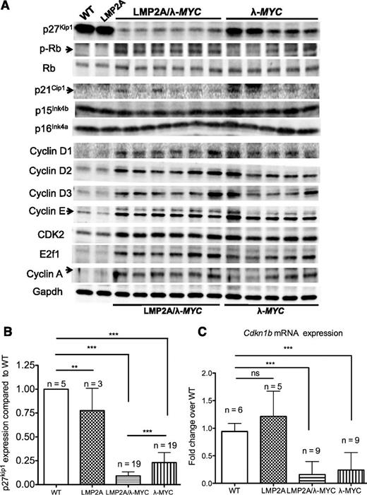 Figure 2. P27Kip1 is downregulated at the protein level, but not at the mRNA level, in pretumor B cells from LMP2A/λ-MYC mice compared with those in λ-MYC mice. (A) Representative western blots of cell cycle regulators in purified B cells from 3-week-old mice of indicated genotypes (C57BL/6 background). Each lane represents a protein sample from one mouse. (B) P27kip1 protein expression in B cells from 3-week-old mice shown as a ratio to WT expression from 5 independent experiments. (C) qRT-PCR analyses of Cdkn1b expression from 2 independent experiments using a WT mouse as a control for each experiment. All differences in mRNA and protein expression were analyzed by 1-way ANOVA. **P < .01, ***P < .001; ns, not significant. Data represent the mean ± SD.