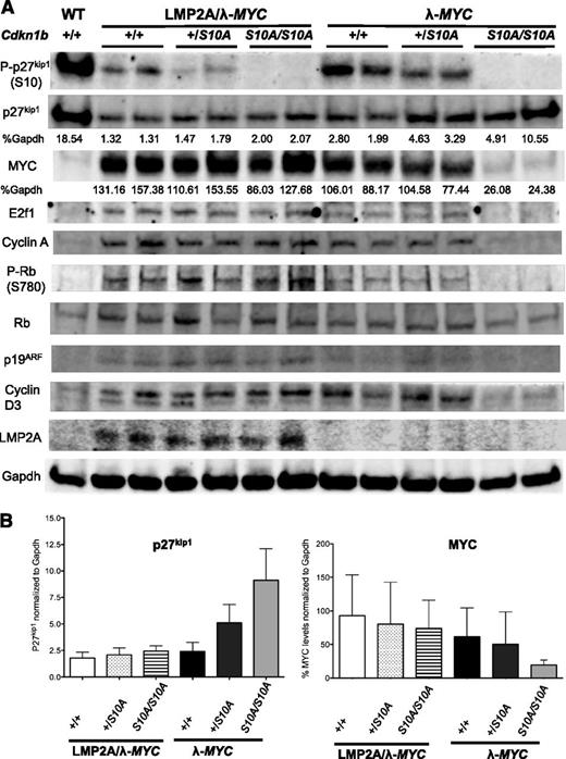 Figure 6. LMP2A expression associates with high MYC level, which inversely correlates with low p27kip1 levels. (A) Western blot analyses of cell cycle regulators in purified B cells from 3-week-old WT, LMP2A/λ-MYC+/+, LMP2A/λ-MYC+/S10A, LMP2A/λ-MYCS10A/S10A, λ-MYC+/+, λ-MYC+/S10A, and λ-MYCS10A/S10A mice. Cyclin A was used as an S-phase marker. Normalized levels of p27kip1 and MYC are shown as percentages to Gapdh (loading control). (B) Bar graphs demonstrating MYC and p27kip1 protein expression in B cells from 3-week-old mice from 2 independent experiments. Each bar represents combined data from 4 experiments, with data represented as the mean ± SD.