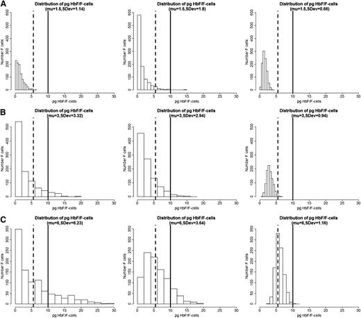 Figure 1. Hypothetical distribution of HbF/F-cell and the percent F-cells in 3 patients with HbF levels of 5%, 10%, and 20%. (A) HbF 5%. (B) HbF 10%. (C) HbF 20%. Plots were generated by simulating a sample of 1000 cells in each plot using a β distribution defined in the range 0 to 30, with mean HbF content per cell of 5% (μ = 1.5 pg), 10% (μ = 3 pg), and 20% (μ = 6 pg). With a fixed mean, the standard deviation (SDev) was changed to show how the distribution of HbF per cell can greatly vary even if the mean is the same (see text for additional details). The simulations were conducted using the R package.21 Vertical dashed lines show the approximate lower level of HbF/F cells needed to detect F-cells by fluorescence-activated cell sorter, and the solid vertical line shows the approximate lower level of HbF needed to protect the cell from deoxyHbS polymerization at physiologic O2 saturations.