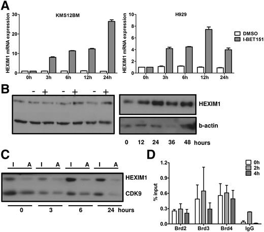 Figure 5. Role of HEXIM1 in the antiproliferative effect of I-BET151. (A) RQ-PCR analysis of MYC and HEXIM1 mRNA expression in H929 and KMS12BM myeloma cells over 24 hours after treatment with I-BET151 (1 μM) or DMSO control. Expression is normalized against the RNA levels at t = 0. Data shown are representative of 2 independent experiments; mean ± SEM of technical triplicate assays for each time point is shown. (B) HEXIM1 protein levels in H929 myeloma cells as assessed by immunoblotting after treatment with I-BET151 1 μM (+) or DMSO (−) control at the time points indicated. Two immunoblots with different time points are shown. (C) Relative levels of active (HEXIM1-free) and inactive (HEXIM1-bound) CDK9 upon treatment with I-BET151 (1 μM) of H929 cells. Following differential salt extraction of nuclei and running of low- (inactive CDK9 fraction) and high-salt (active CDK9 fraction) extracts for each time point side-by-side on sodium dodecyl sulfate polyacrylamide gel electrophoresis, the same membrane was immunoblotted with anti-HEXIM1 and CDK9 antibody. (D). ChIP assay performed under the same conditions described in Figure 4, showing occupancy at HEXIM1 promoter of BRD2-4 at 0, 2, and 4 hours after treatment with I-BET151 (1 μM; n = 3). I, inactive CDK9; A, active CDK9.