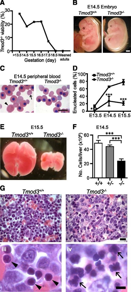 Figure 3. Tmod3−/− mice are embryonic lethal with anemia. (A) Viability of Tmod3−/− embryos. Timed matings of Tmod3+/− intercrosses were performed and embryos were harvested at stages E13.5 up to E18.5. The percentages reflect the numbers of live Tmod3−/− embryos with respect to all embryos harvested in litters at each gestational stage. (B) Gross morphology of Tmod3+/+ and Tmod3−/− embryos at E14.5. Scale bar, 1 mm. (C) Wright-Giemsa staining of peripheral blood cytospins from Tmod3+/+ and Tmod3−/− embryos at E14.5. Large primitive enucleated RBC (arrowhead); smaller definitive enucleated RBC (arrow). Note that sizes of enucleated cells from Tmod3−/− embryos are variable and do not fall into clear size categories. Scale bar, 20 µm. (D) The percentage of enucleated RBCs in peripheral blood cytospins from Tmod3+/+ and Tmod3−/− embryos at E13.5, E14.5, and E15.5. At least 300 cells were counted for each sample. Values are means ± SD (n = 5 to 13). ***P < .001. (E) Gross morphology of representative fetal livers from Tmod3+/+ and Tmod3−/− embryos at E15.5. (F) Total number of fetal liver cells from Tmod3+/+ (n = 7), Tmod3+/− (n = 18), and Tmod3−/− (n = 5) embryos at E14.5. Values are means ± SD. ***P < .001. (G) Hematoxylin and eosin staining of paraffin sections from Tmod3+/+ and Tmod3−/− fetal livers fixed in Bouin’s solution. Normal orthochromatic erythroblast nuclei in Tmod3+/+ fetal liver (arrowheads). Abnormal multilobular orthochromatic erythroblast nuclei in Tmod3−/− fetal liver (arrows). Scale bar, 10 µm (i-ii); 5 µm (iii-iv). Panels C and G were acquired with a Zeiss Axioskop microscope with AxioCam ICc3 color camera using a ×20 objective (N.A. 0.5) at a zoom of 2 (Gi-ii) or a ×100 oil-immersion objective (N.A. 1.3) at a zoom of 1 (C and Giii-iv).