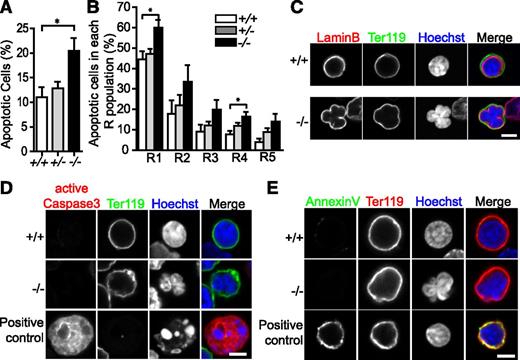 Figure 5. Tmod3−/− fetal liver erythroblasts display increased apoptosis throughout terminal differentiation. (A) Percentage of apoptotic cells based on Annexin V-positive cells as a proportion of total 7-AAD–negative fetal liver cells at E14.5. (B) Percentage of apoptotic cells within each R population. The 7-AAD–negative cells were first gated on CD71/Ter119 to identify R populations as in Figure 4C, and percentages for each R was calculated as the number of Annexin V-positive cells as a fraction of the total cell number in that R population. All values are means ± SD with at least 3 replicates with samples prepared from different individual embryos. *P < .05. (C) Cytospins of fetal liver cells stained with lamin B (red) for nuclear envelope, Ter119-Alexa488 (green) for a GPA-associated antigen to identify late erythroblasts, and Hoechst (blue) for nuclei. (D) Cytospins of fetal liver cells stained with active-caspase3 (red) for apoptosis, Ter119-Alexa488 (green), and Hoechst (blue). (E) Cytospins of fetal liver cells stained with Annexin V (green) for apoptosis, Ter119-PE (red), and Hoechst (blue). Panels C-E were acquired with a Zeiss LSM 780 laser scanning confocal fluorescence microscope using a Zeiss 100× oil-immersion objective (N.A. 1.4) at a zoom of 2. Scale bar, 4 µm.