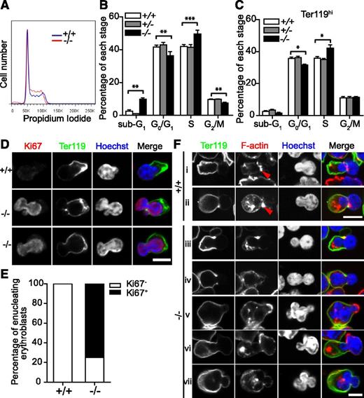 Figure 6. Cell-cycle progression and actin cytoskeleton structures are impaired during erythropoiesis in Tmod3−/− fetal liver. (A) Representative flow cytometry profiles of cell-cycle analysis of fetal liver cells at E14.5 after PI staining. (B) Percentages of fetal liver cells in sub-G1, G0/G1, S, and G2/M phase. (C) Percentages of Ter119hi fetal liver cells in sub-G1, G0/G1, S, and G2/M phase. All values are means ± SD with at least 3 replicates. **P < .005; ***P < .001 for Tmod3−/− vs Tmod3+/+. (D) Confocal fluorescence microscopy images of enucleating Tmod3+/+ or Tmod3−/− erythroblasts stained with Ter119-Alexa488 (green), Ki67 (red), and Hoechst (blue), and imaged in cytospins. Scale bar, 4 µm. (E) Percentages of enucleating Ki67+ and Ki67- erythroblasts in Tmod3+/+ or Tmod3−/− fetal livers. (F) Confocal fluorescence microscopy images of enucleating Tmod3+/+ (i-ii) and Tmod3−/− (iii-vii) erythroblasts, imaged in cytospins of fetal liver cells stained with Ter119-Alexa488 (green), rhodamine-phalloidin (red), and Hoechst (blue). Enucleating erythroblasts were identified in both genotypes by membrane sorting of Ter119 staining, and a nuclear constriction at the transition between the bright and dim Ter119 membrane staining. F-actin assembles into a contractile actin ring at the neck region in Tmod3+/+ enucleating erythroblasts and in bright foci in the cytoplasm of the incipient reticulocyte (i-ii). Tmod3−/− enucleating erythroblasts occasionally have an F-actin contractile ring (iii), but not always (iv-vii), and sometimes have F-actin enrichment on the dim Ter119 membrane overlying a protruding nuclear lobe (v-vi). Similar to wild-type, Tmod3−/− enucleating erythroblasts also contain F-actin foci in the cytoplasm (iii-vii). Scale bar, 6 µm. Panels D, Fiii-vii were acquired with a Zeiss LSM 780 laser scanning confocal microscope using a Zeiss 100× oil immersion objective (N.A. 1.4) at a zoom of 2, and panels Fi-ii with a Bio-Rad Radiance 2100 confocal microscope using a Zeiss 100× oil-immersion objective (N.A. 1.2) at a zoom of 3.