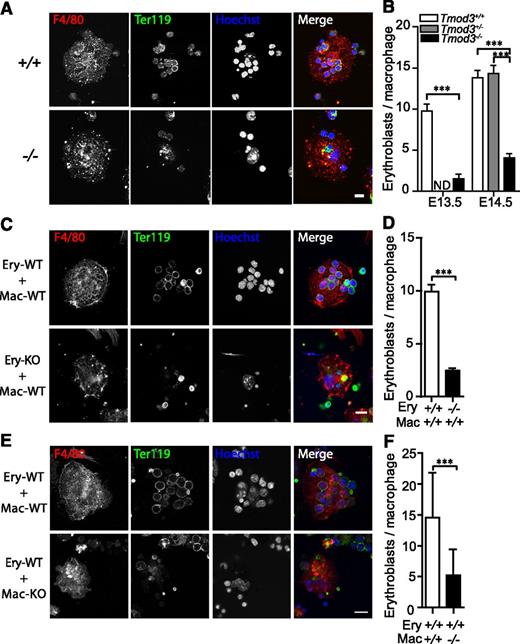 Figure 7. Tmod3 is required in both erythroblasts and macrophages for erythroblast-macrophage island formation in the fetal liver. (A) Representative images of native islands isolated from fetal livers at E14.5. Cells were stained with F4/80-Alexa647 (red) for macrophages, Ter119-Alexa488 (green) for erythroblasts, and Hoechst (blue) for nuclei. (B) Numbers of erythroblasts bound per macrophage at E13.5 and E14.5. Islands were prepared from 3 independent litters and 30 to 90 islands were counted for each genotype. (C) Representative images of reconstituted islands from Tmod3+/+ or Tmod3−/− erythroblasts (Ery) incubated with Tmod3−/− macrophages (Mac). (D) Numbers of erythroblasts bound per macrophage. For each cell combination, 3 independent litters with a total of 80 to 100 islands were counted (9.9 ± 0.7 Tmod3+/+ erythroblasts, but only 2.5 ± 0.2 Tmod3−/− erythroblasts bound to each wild-type macrophage). (E) Representative images of reconstituted islands from Tmod3+/+ erythroblasts (Ery) incubated with Tmod3+/+ or Tmod3−/− macrophages (Mac). (F) Numbers of erythroblasts bound per macrophage. For each cell combination, 3 independent litters with a total of 70 to 80 islands were counted; 14.6 ± 0.9 wild-type erythroblasts were attached to each Tmod3+/+ macrophage, while only 5.2 ± 0.5 were attached to each Tmod3−/− macrophage. All values are means ± SD. ***P < .001. Panels A, C, and E were acquired using a Bio-Rad Radiance 2100 confocal microscope with a Zeiss 63× oil immersion objective (N.A. 1.4). Scale bar, 10 µm. ND, not determined.