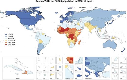 Total YLD due to anemia in 2010, by country. Anemia makes important contributions to disease burden in most low- and middle-income countries. The burden of anemia remains highest in sub-Saharan Africa, with South Asia also heavily affected.