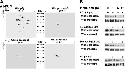 Figure 2. Procasp8 emerges as Lyn’s substrate within B-CLL cytosolic tyrosine phosphoproteome. (A) Cytosol purified from freshly isolated B cells from 12 B-CLL patients equally distributed between the UM-CLL and M-CLL subsets was separated by 2D-PAGE using a linear narrow range (pH 4-7) immobilized pH gradient in the first dimension for subsequent Wb analysis with anti-pTyr and anti-p-procasp8 antibodies, respectively. Blots were then stripped and reprobed with anti-procasp8 antibody. The figure, though showing the Wb patterns of patient 14, is representative of all the samples tested. (B) Whole B-cell lysates of freshly isolated B-CLL cells cultured in the absence or presence of 10 μM PP2, 7.5 μM SU6656, 0.1 μM dasatinib, or 10 nM GA at different time points underwent Wb analysis with anti-p-procasp8 and anti-procasp8 antibodies. The figures are representative of samples from 10 CLL patients belonging to 2 different subsets UM and M-CLL composed of 5 samples each.