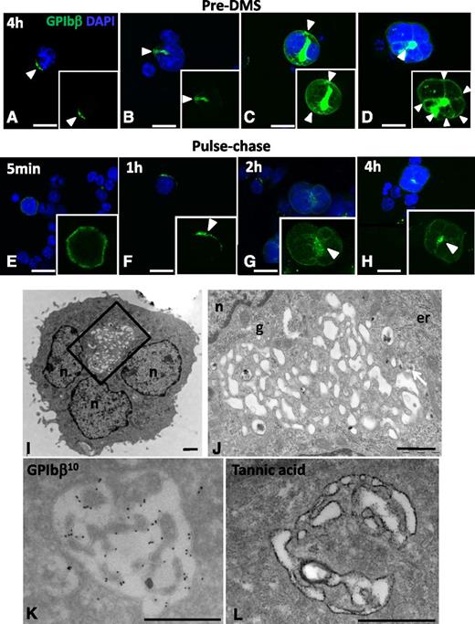 Figure 1. DMS onset and expansion in cultured MKs. (A-D) Confocal images from MK cultures fixed after 4 hours. Cells were stained with anti-GPIbβ (green) and DAPI (blue); full Z-stacks of the representative DMS developmental stages are assembled as maximum intensity projections. (A-B) Distinct GPIbβ-positive territories at and just beneath the cell surface (arrowheads) were observed in MKs. Note the connection with the cell surface (supplemental Movies 1 and 2). (C-D) In larger MKs, GPIbβ-positive areas (pre-DMS) were centrally located between the nuclear lobes and displayed numerous tubular connections with the cell surface (arrowheads in D). Bars, 10 µm. (E-H) Pulse-chase kinetics of anti-GPIbβ in cultured MKs. Lin− BM cells were pulse-labeled for 15 minutes with Alexa488-conjugated anti-GPIb (green), washed, and subsequently fixed after 5 minutes and 1, 2, and 4 hours, respectively. Representative maximal projections of whole cells are shown. Bars, 10 µm (I-L) Ultrastructural characterization of the pre-DMS in cultured MKs. TEM images showing pre-DMS in MKs cultured for 4 hours. (I) At this stage, the pre-DMS is a well-defined circular membrane network located between the lobes of the nucleus. (J) Higher magnification of the network. (K) Immunogold labeling with anti-GPIbβ (10 nm protein A gold particles) showing that the pre-DMS contains GPIbβ. (L) Tannic acid staining reveals that the pre-DMS is connected o the cell surface. Bars, 1 µm. er, endoplasmic reticulum; g, golgi; n, nucleus.