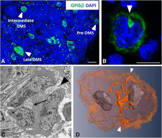 Figure 2. Detection of pre-DMS in bone marrow MKs. (A) View of a 100-µm-thick BM section with immunofluorescence staining as indicated on the figure. The different stages of development of the DMS (pre-, intermediate, and late) are identified by the anti-GPIbβ antibody. Bar, 20 µm. (B) Higher-magnification confocal image of a typical stage I MK showing GPIbβ at the cell periphery and the pre-DMS (arrow) connected to and located just beneath the cell surface, between the nuclear lobes (see supplemental Movie 3 for the complete Z-stack analysis). Bar, 10 µm. (C) Representative TEM image of the pre-DMS. Note the well-defined boundary, the precise localization in the perinuclear region (arrow) between the nuclear lobes, and the connection with the cell surface (arrowhead). Bar, 2 µm (D) 3D reconstruction from an FIB/SEM analysis of the pre-DMS (orange) in a bilobulated immature MK. Note that the pre-DMS is precisely positioned between the 2 lobes of the nucleus and is already branched at this early stage of development. The arrowhead indicates a connection with the cell surface.