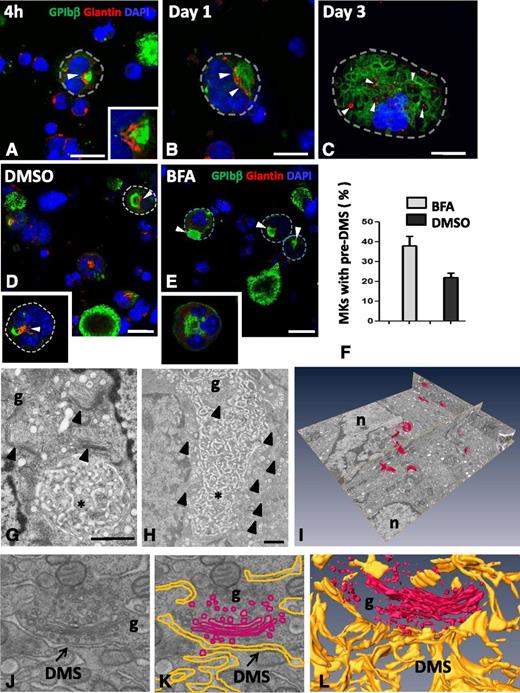 Figure 4. Golgi complexes are in close position to the pre-DMS and contribute to DMS growth. MKs were cultured for 4 hours or for 1 or 3 days. The cells were permeabilized and immunostained for the Golgi marker giantin (red) and GPIbβ (green). (A-C) Representative confocal images are shown at different developmental stages of the DMS. (A) Giantin staining is confined to the perinuclear region and lies close to the pre-DMS (inset of boxed area). (B) Close association but no colocalization of giantin with the intermediate DMS. Note that the size of the giantin spots increases at these later stages (white arrowheads). (C) Giantin spots become randomly distributed in MKs at the latest stages of maturation (white arrowheads). Bars, 10 µm. (D-E) Confocal images of MKs cultured for 20 hours and treated as indicated. Note the absence of Golgi staining after BFA treatment. Dotted lines indicate cell perimeters. Bars, 10 µm. (F) Quantification of the number of MKs displaying typical pre-DMS areas. (G-H) Electron micrographs showing the presence of Golgi complexes (arrowheads) in proximity to the pre-DMS between (G) 2 nuclear lobes or (H) the intermediate DMS. Bars, 500 nm. (I) A typical FIB/SEM analysis illustrating the 3D visualization of all the Golgi complexes (red) detected in a large volume (∼34 µm3) of a stage II MK. (J) Higher magnifications of the FIB/SEM analysis showing close apposition of Golgi-derived vesicles at the boundary of the DMS. (K) Segmentation of the DMS (yellow) and the Golgi (red). (L) 3D reconstruction. *DMS. Bars, 1 µm. g, Golgi stacks; n, nucleus.