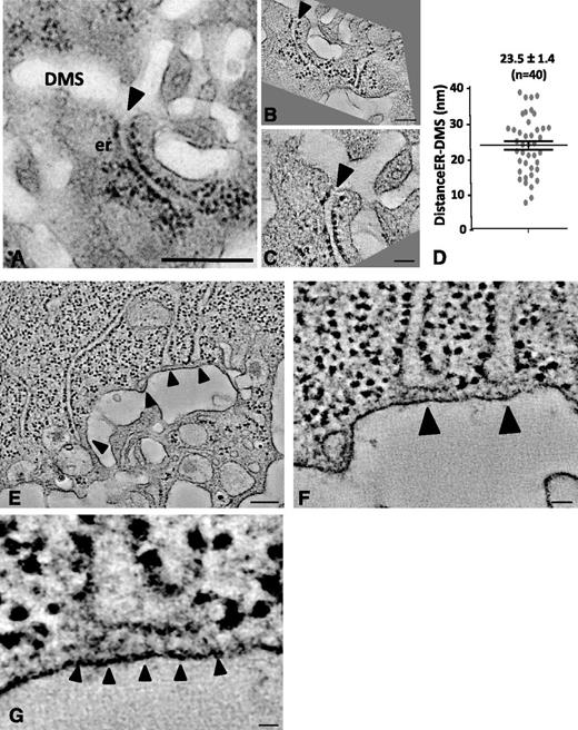 Figure 6. Dual axis electron tomography of ER-DMS contacts. (A) TEM image of a stage II MK showing a tubular ER cisterna extending toward the DMS. Bar, 500 nm. (B-C) Tomographic sections from a dual axis tomogram of the area in A. Note that the membranes of the DMS and ER are closely apposed but not in continuity (arrowheads). Bars, 100 nm. (D) Minimal distance in nm between the ER and DMS, as quantified from 40 contact sites in 6 tomograms. (E-G) Selected tomographic sections (∼5 nm thick) of tubular ER cisternae (arrowheads) extending toward the DMS. Bar, 100 nm. (F-G) Selected Z-orientations from the tomogram revealing filamentous structures connecting ribosome-free ER domains with the DMS. Bars, 10 nm. er, endoplasmic reticulum.
