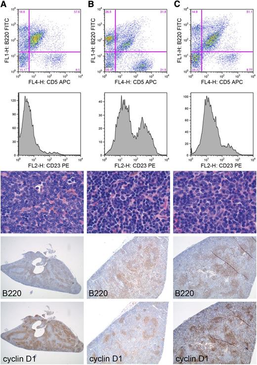 Figure 4. Development of MCL in EμCycD1CD19CREBimfl/fl mice treated with SRBC and pristane. (A-C) Disease manifestations of distinct EμCycD1CD19CREBimfl/fl mice. First row: Flow cytometry of splenic mononuclear cells (y-axis B220, x-axis CD5). Second row: Flow cytometric analysis of the B220+CD5+ cells for expression of CD23, plotted as a histogram. Third row: Hematoxylin and eosin staining of spleens (original magnification: ×1000). Fourth row: B220 immunohistochemistry (original magnification, left to right: ×20, ×40, ×40). Fifth row: cyclin D1 immunohistochemistry (original magnification, left to right: ×20, ×40, ×40). APC, allophycocyanin; FITC, fluorescein isothiocyanate; PE, phycoerythrin.
