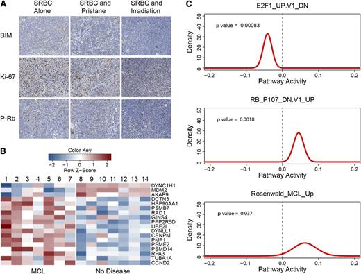 Figure 7. Cell-cycle analysis of EμCycD1CD19CREBimfl/fl mice that developed MCL. (A) Spleens from mice treated with weekly SRBC alone (first column), SRBC and pristane (second column), or SRBC and irradiation (third column) all show absence of BIM expression (first row), high Ki-67 staining (second row), and scattered phosphorylated-retinoblastoma protein expression (third row). (B) Gene expression profiling was performed on spleens from EμCycD1CD19CREBimfl/fl mice stimulated with SRBC alone (2, 5, and 6), SRBC with irradiation (1, 3, and 7), or SRBC with pristane (4) that developed MCL (n = 7) and compared with EμCycD1CD19CREBimfl/fl mice stimulated with SRBC alone (8 and 9), SRBC with irradiation (12-14), or SRBC with pristane (10 and 11) that did not develop disease (n = 7). Shown are gene expression intensities (row normalized) of cell cycle–related genes that manifested statistically significant differential regulation. (C) Probability densities for gene set activity estimated by QuSAGE of MCL-bearing vs nondiseased EμCycD1CD19CREBimfl/fl mouse spleens for genes downregulated in E2F1 overexpressing cells (top), genes upregulated in retinoblastoma protein–deficient cells (middle), and genes that comprise a human MCL signature (bottom).