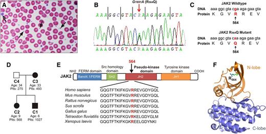 Figure 1. Patient with JAK2R564Q mutation displays MPN. (A) Examination of the index patient's blood smear revealed increased platelet number. Platelet morphology and granulation were normal, and most platelets were of normal size (black arrows). Rarely, however, giant platelets were observed (open arrow). (B) Sequence analysis revealed a novel G-to-A single-point mutation in JAK2 at nucleotide 1691, causing an amino acid substitution of arginine for glutamine at position 564 (C). (D) Pedigree of the studied ET family. Squares represent males, circles represent females. JAK2R564Q-positive family members are shown in black, and the JAK2R564Q-negative member in white. Plts indicates platelet counts of each family member (×103/μL). (E) Alignment of JAK2 sequences from different species shows that the arginine at position 564 in the pseudokinase domain is highly conserved. (F) Three-dimensional model of the JAK2 JH2 pseudokinase domain based on Bandaranayake et al16 with the N lobe colored orange and the C lobe colored blue. Arginine 564 (R564) is located in the 5 stranded β sheet of the N lobe.