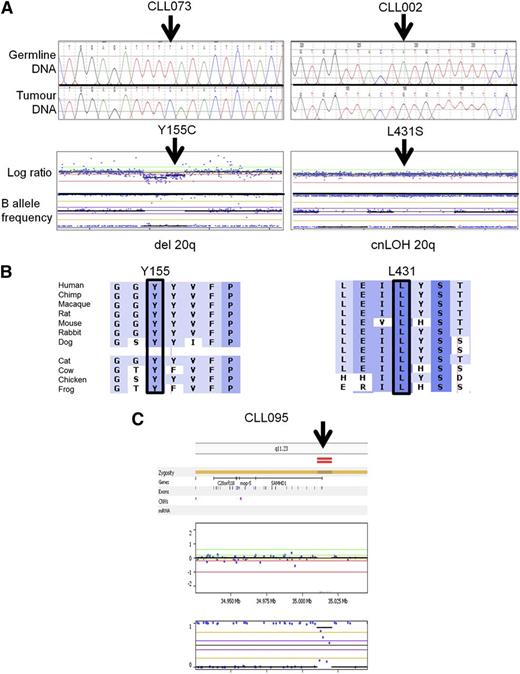 Figure 2. Representative examples of somatic SAMHD1 mutations. (A) Electropherogram of SAMHD1 mutations using paired germ-line and tumor DNA. (Upper) Representative results from 2 patients are depicted. (Lower) Whole genome arrays showing (left) copy neutral loss of heterozygosity (cnLOH) or (right) a heterozygous deletion over chromosome 20 involving the SAMHD1 locus. (B) Multiple sequence alignment of SAMHD1 around the mutated residue (arrow) of each patient. Degree of conservation is reflected by background color code (dark blue, highly conserved to white, not conserved). (C) Whole genome array showing a small homozygous deletion at the 5′ end of the SAMHD1 locus in patient CLL 095.