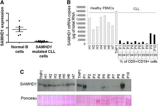 Figure 4. Expression profiles of SAMHD1 in primary CLL cells. (A) cDNA pools from B cells (CD19+, CD5−) sorted from peripheral blood of healthy donors and SAMHD1-mutated CLL cells (CD19+, CD5+) were subjected to quantitative PCR analysis using ABL as a control gene. (B) Measurement of SAMHD1 mRNA by quantitative RT-PCR. The percentage of leukemia cells (CD5+/CD19+) is indicated. Statistical comparison of SAMHD1 mRNA levels between each CLL sample and the mean of the healthy PBMCs was performed. The black bars indicate P < .01. (C) Measurement of SAMHD1 protein levels by western blot in 10 CLL samples and 7 healthy PBMCs. Ponceau dye staining was used to control protein load.
