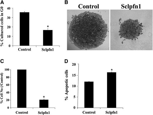 Figure 4. Pfn1 supports the survival of HSCs. (A) Cultured HSCs were stained with Hoechst 33342 and pyronin Y and analyzed for cell cycle stage. The percentages of G0 cells in cultured control and Sclpfn1 HSCs are shown (n = 3; *P < .05). (B) LT-HSCs (as Lin−Sca-1+Kit+Flk2−CD34− cells) were isolated from control and Sclpfn1 mice 4 days after tamoxifen treatment and cultured in STF medium for 8 to 10 days. Figures are representative for samples after a 10-day culture. (C) Quantification of control and Sclpfn1 HSCs after 10 days in culture (n = 3; *P < .05). (D) Cultured HSCs from control and Sclpfn1 mice were analyzed for apoptosis using Annexin V/7-AAD staining (n = 3; *P < .05).
