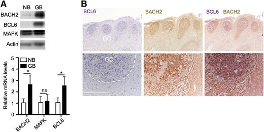 Figure 1. Positive correlation of BCL6 and BACH2 expression in human GC B cell. (A) Immunoblot and quantitative reverse-transcription polymerase chain reaction (qRT-PCR) analysis of BCL6, BACH2, and MAFK expression in naïve B cells (NB) and GC B cells (GB) purified from human tonsils. For qRT-PCR analysis, data are shown as mean ± standard error of the mean from 3 different sets of NBs and GBs. *P < .01; ns, not significant; 2-tailed Student t test. (B) Immunohistochemistry analysis of BCL6 (blue) and BACH2 (brown) in human tonsil sections. Bars represent 200 μm.