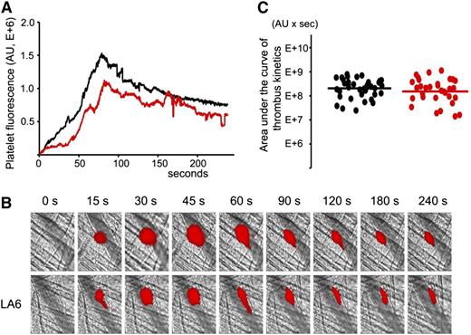 Figure 5. LA6, which does not bind β2GPI, does not inhibit thrombus size in (NZW × BXSB)F1 mice. In vivo imaging of platelet accumulation at the site of injury in 13- to 14-week-old male (NZW × BXSB)F1 mice after laser-induced thrombosis in cremaster muscle arterioles in the absence of LA6 and after the infusion of LA6 at a dose of 4 μg/g mouse. (A) Median-integrated platelet fluorescence studied in 6 mice in the absence of LA6 (black curve, 37 thrombi) and in the presence of LA6 (red curve, 33 thrombi). (B) Snapshots of platelet accumulation at the site of injury over time. Comparison of 2 representative thrombi generated in the same mouse in the absence (top row) and in the presence (bottom row) of LA6. (C) Sizes of individual thrombi collected in the absence (black circles) and in the presence of LA6 (red circles). Lines correspond to areas under the curves of the median-integrated fluorescence calculated for all thrombi in each data set collected in 6 mice. The difference between 2 data sets is not statistically significant (P = .42).