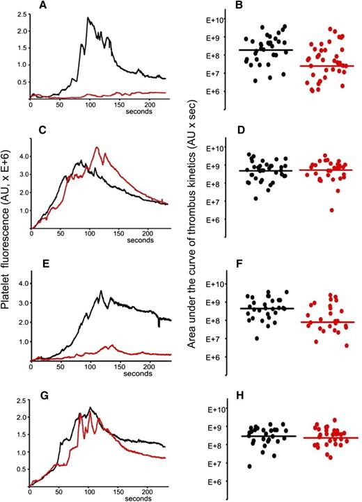 Figure 6. A1-A1 inhibits thrombus size in BALB/c mice in the presence of anti-β2GPI antibodies and does not affect thrombus size in the absence of anti-β2GPI antibodies. (A-B) Anti-β2GPI–positive APS IgG (2 mg per mouse) and A1-A1 (4 μg/g mouse). (A) Median-integrated platelet fluorescence studied in 4 mice in the absence (black curve, 33 thrombi) and in the presence (red curve, 39 thrombi) of A1-A1. In the presence of A1-A1, thrombus size decreased to 13% of the thrombus size in the absence of A1-A1 (P = .001). (B) Area under the curve of individual thrombi collected in the absence (black circles) and in the presence of A1-A1 (red circles). (C-D) Anti-β2GPI–positive APS IgG (2 mg per mouse) and LA6 (4 μg/g mouse). (C) Median-integrated platelet fluorescence studied in 7 mice in the absence (black curve, 37 thrombi) and in the presence (red curve, 30 thrombi) of LA6. (D) Area under the curve of individual thrombi collected in the absence (black circles) and in the presence of LA6 (red circles). The difference between 2 data sets is not statistically significant. (E-F) Purified patient anti-β2GPI IgG (16 μg per mouse) and A1-A1 (4 μg/g mouse). (E) Median-integrated platelet fluorescence studied in 4 mice in the absence (black curve, 29 thrombi) and in the presence (red curve, 26 thrombi) of A1-A1. In the presence of A1-A1, thrombus size decreased to 18% of the thrombus size in the absence of A1-A1 (P = .007). (F) Area under the curve of individual thrombi collected in the absence (black circles) and in the presence of A1-A1 (red circles). (G-H) PBS and A1-A1 (4 μg/g mouse). (G) Median-integrated platelet fluorescence studied in 4 mice in the absence (black curve, 28 thrombi) and in the presence (red curve, 29 thrombi) of A1-A1. (H) Area under the curve of individual thrombi collected in the absence (black circles) and in the presence of A1-A1 (red circles). The difference between 2 data sets is not statistically significant. Lines on panels B, D, F, and H correspond to areas under the curves of the median-integrated fluorescence calculated for all thrombi in a data set.