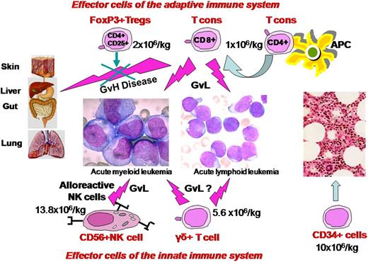 Figure 1. Composition and mechanism of action of a new “designed” graft. It contains a megadose of CD34+ cells that are depleted of TCRαβ+/CD19+ cells plus adoptive immunotherapy with FoxP3Tregs and Tcons in an established ratio of 2:1. Besides the GVL effect, Tcons, NK cells, and TCRγδ+ T cells hasten immune reconstitution.