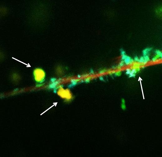 Fluor imaging analysis showing colocalization of histones, DNA, and nonanticoagulant heparin (yellow dots, arrows) on neutrophils (red surface). See the complete Figure 1 in the article by Wildhagen et al that begins on page 1098.