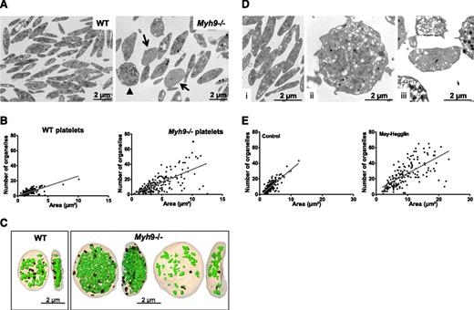 Figure 1. Abnormal distribution of organelles in mouse Myh9−/− and human MYH9-RD platelets. (A) Wide-field electron micrographs of mouse platelets showing the heterogeneous content of Myh9−/− platelets (right) as compared with WT cells (left). Arrows point to low-content platelets and the arrowhead to a high-content platelet. (B) Quantification of the total number of organelles (α and δ granules, lysosomes, and mitochondria) per platelet as observed by TEM. The number of organelles is plotted as a function of the platelet size, and 215 and 190 platelets were analyzed for WT and Myh9−/− mice, respectively. P < .0001 for comparison of variances in the point distribution between WT and Myh9−/− mice. (C) 3D reconstructions from an FIB/SEM analysis showing the face and profile views of 1 WT (left) and 2 Myh9−/− platelets (right). Note the strong heterogeneity in the organelle contents of the Myh9−/− platelets as compared with the WT one. (D) Ultrastructure of human platelets from a control individual (i) as compared with a MYH9-RD patient (ii-iii). (E) Quantification of the number of organelles (α and δ granules, lysosomes, and mitochondria) per platelet as a function of the platelet size, for the MYH9-RD patient (right) and a normal donor (left). Organelles were counted in 178 and 170 platelets for the control and patient, respectively. P < .0001 for comparison of variances in the point distribution.