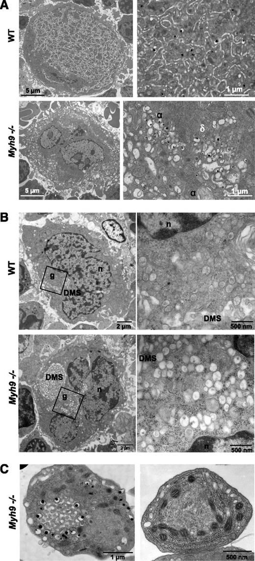 Figure 2. Abnormal MK distribution upon maturation of Myh9−/− MKs. (A) TEM images showing the in situ ultrastructure of WT (top panels) and Myh9−/− (bottom panels) MKs. Higher magnifications (right images) show the normal granule distribution in the WT cytoplasm and clusters of α (α) and dense (δ) granules in Myh9−/− MKs. (B) TEM observations of in situ bone marrow showing the presence of granule clusters (g) located near the nucleus (n) and the developing pre-DMS in immature stage I WT (top panels) and Myh9−/− (bottom panels) MKs. Right images are magnification of left images. (C) Detail showing the abnormal organelle positioning in platelets from Myh9−/− mice. (Left) Dense granules aligned around membrane complex. (Right) Mitochondria aligned along the RER.